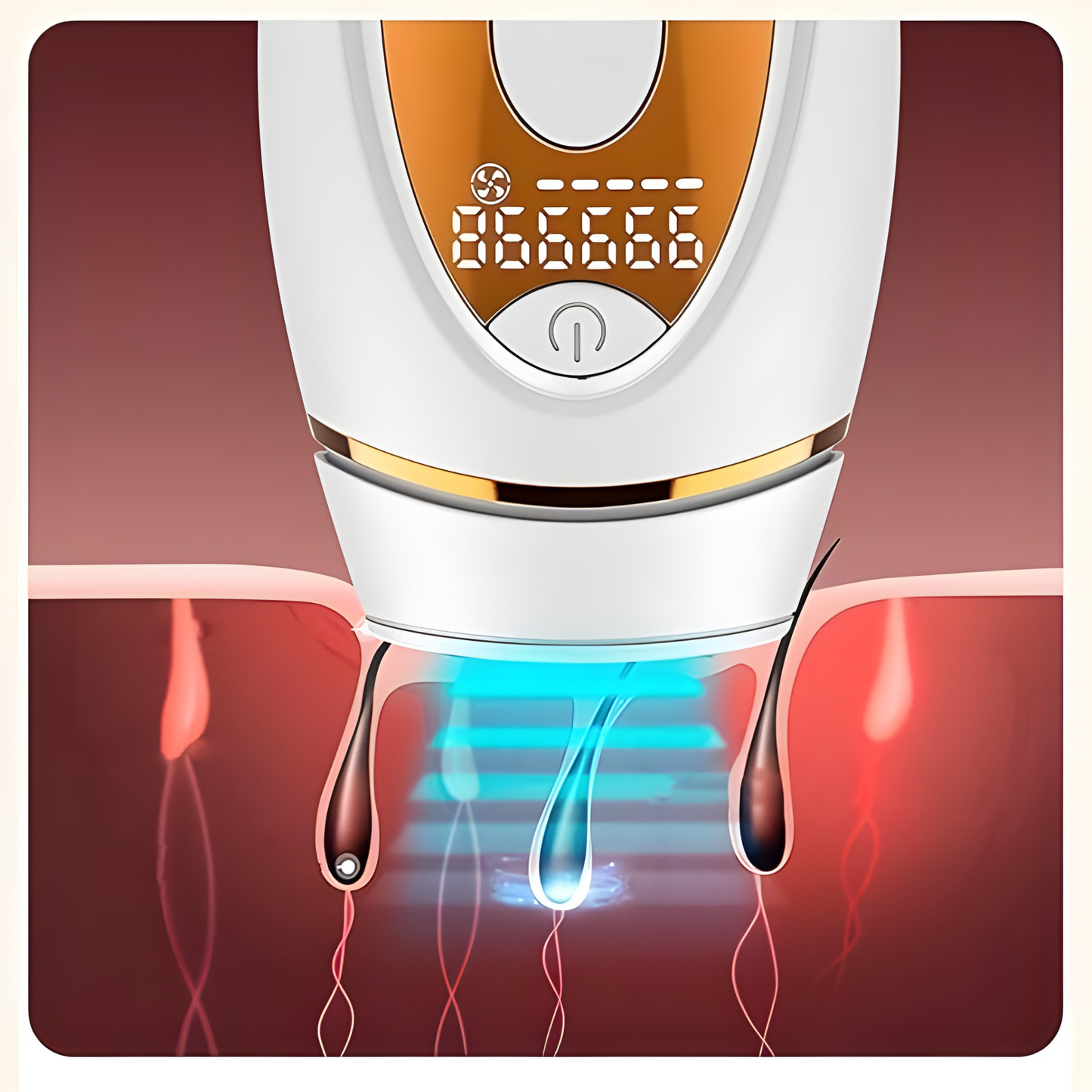 Zerenzi™ - Hair Remover